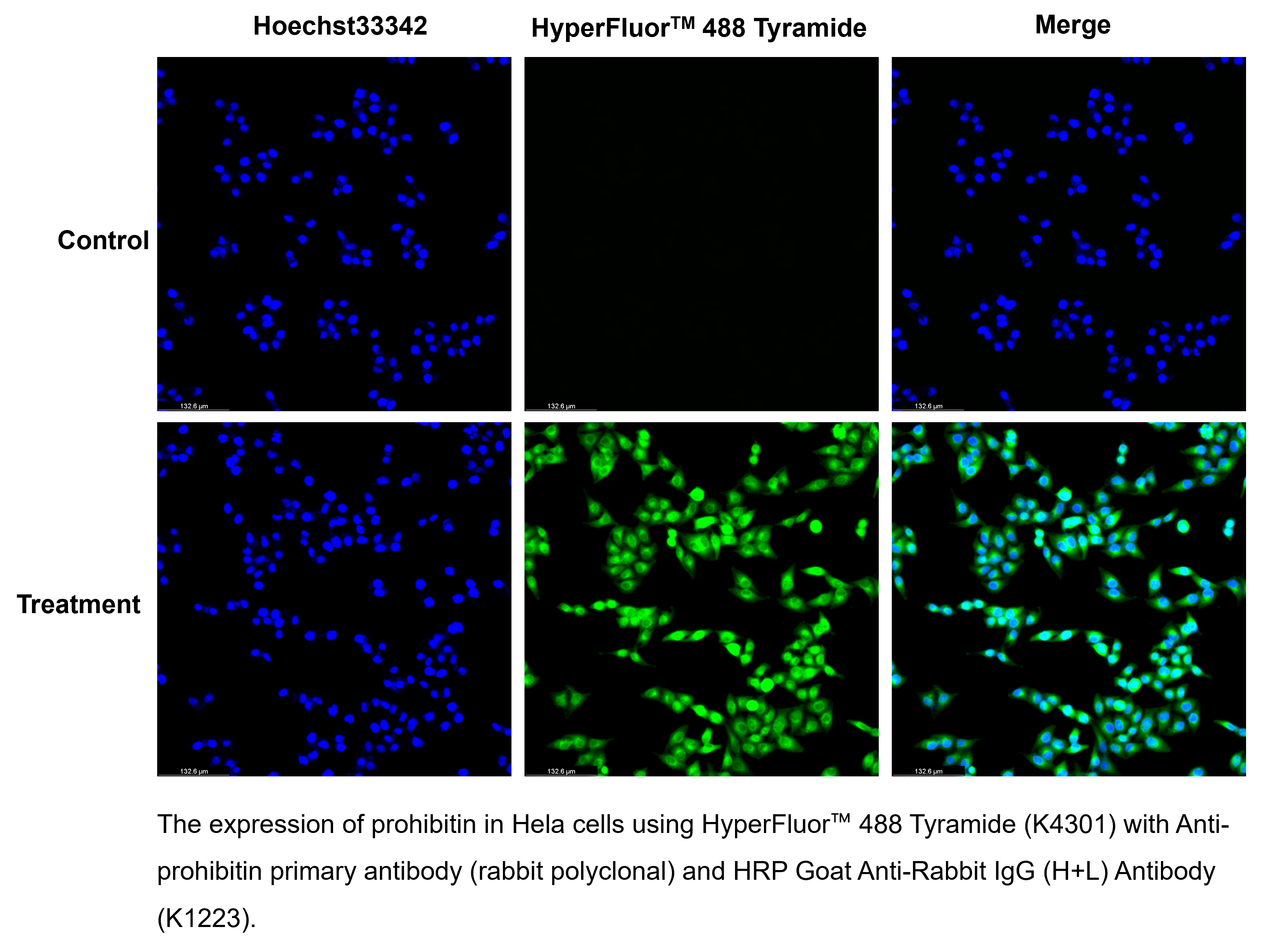 HyperFluor™ 488 TSA Fluorescence System Kit