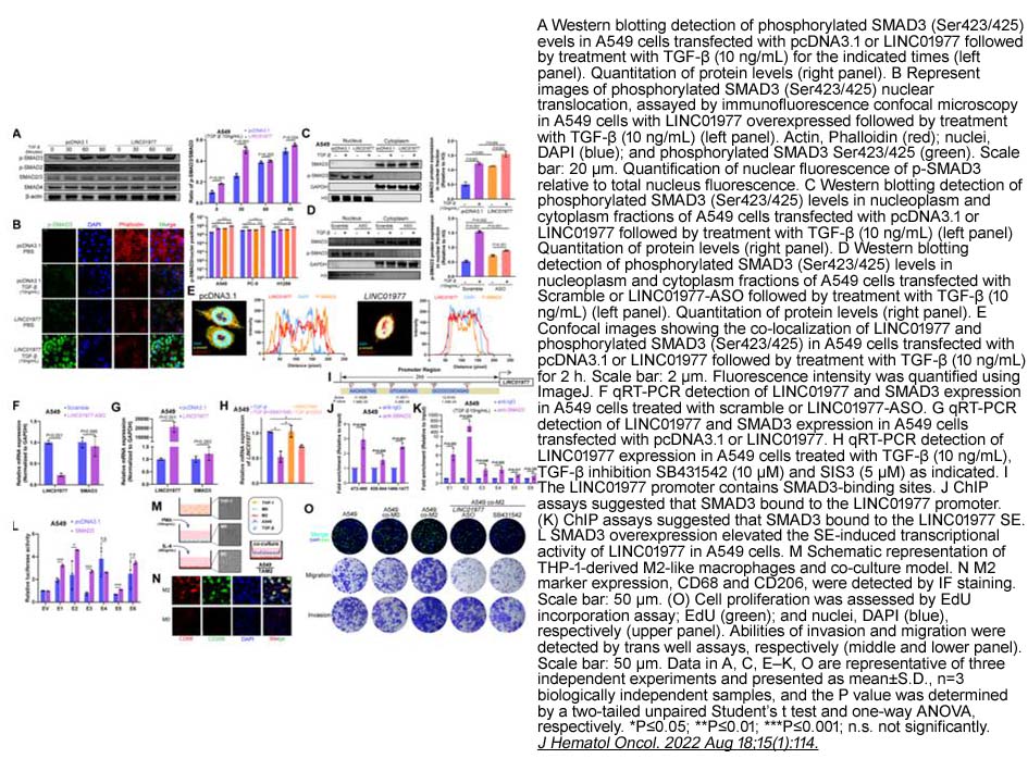 DiscoveryProbe™ TGF-beta/Smad Compound Library DiscoveryProbe™ TGF-beta/Smad Compound Library