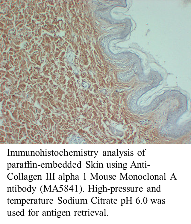 Anti-Collagen III alpha 1 Mouse Monoclonal Antibody Anti-Collagen III alpha 1 Mouse Monoclonal Antibody