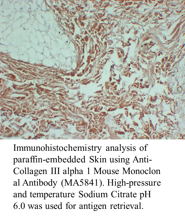 Anti-Collagen III alpha 1 Mouse Monoclonal Antibody Anti-Collagen III alpha 1 Mouse Monoclonal Antibody