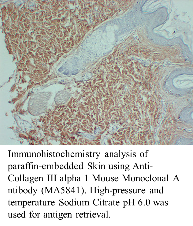 Anti-Collagen III alpha 1 Mouse Monoclonal Antibody Anti-Collagen III alpha 1 Mouse Monoclonal Antibody