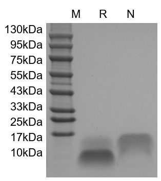 Epidermal Growth Factor (EGF) Epidermal Growth Factor (EGF)