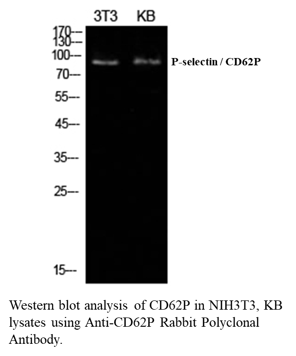 Anti-CD62P Rabbit Polyclonal Antibody