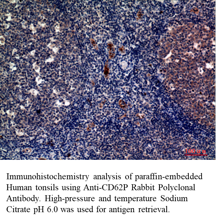 Anti-CD62P Rabbit Polyclonal Antibody