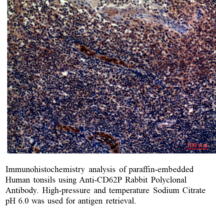 Anti-CD62P Rabbit Polyclonal Antibody