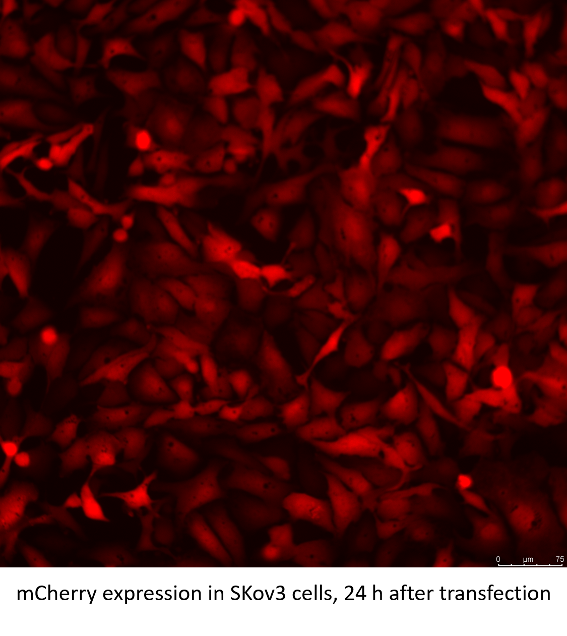 EZ Cap™ mCherry mRNA (5mCTP, ψUTP) EZ Cap™ mCherry mRNA (5mCTP, ψUTP)