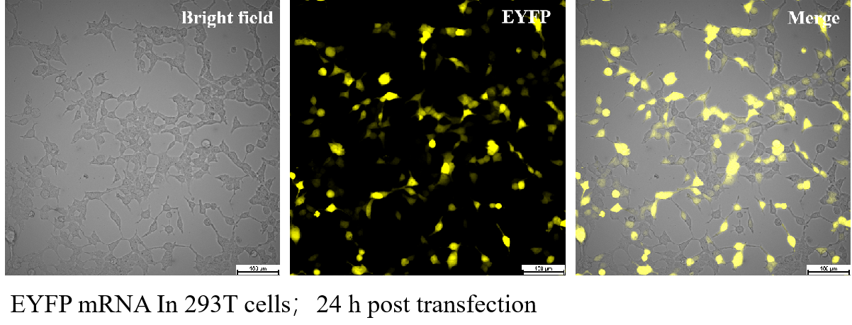 EZ Cap™ EYFP mRNA (m1Ψ) EZ Cap™ EYFP mRNA (m1Ψ)