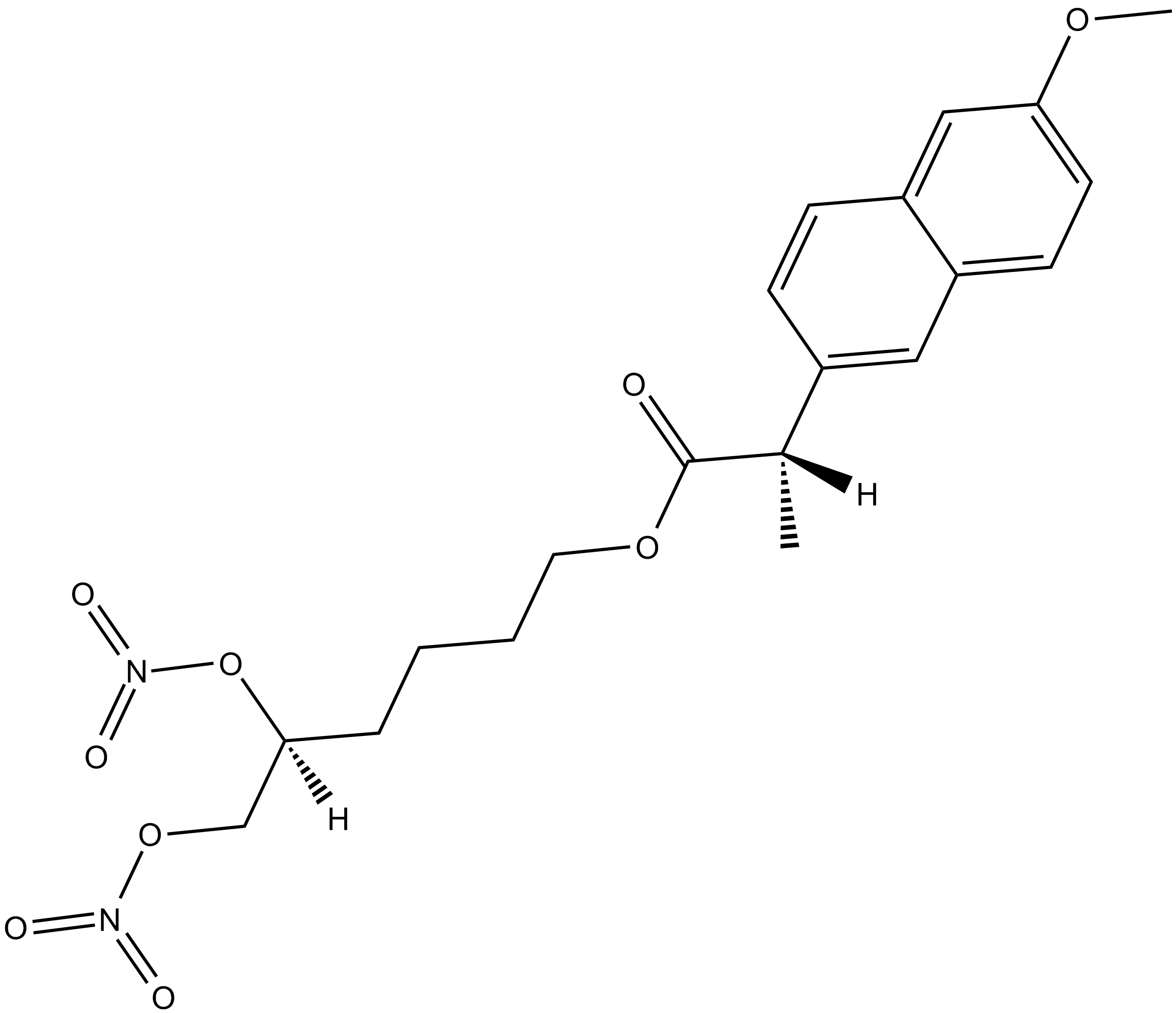 NCX 466