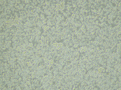 Jurkat Cells