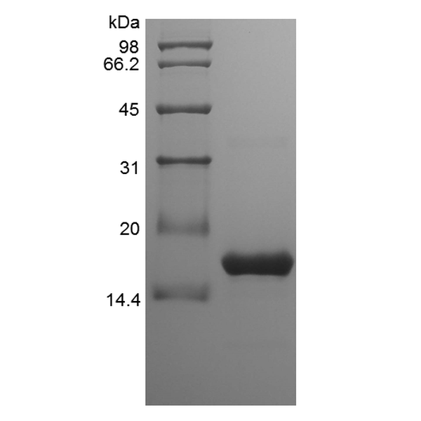 BAFF, human recombinant protein