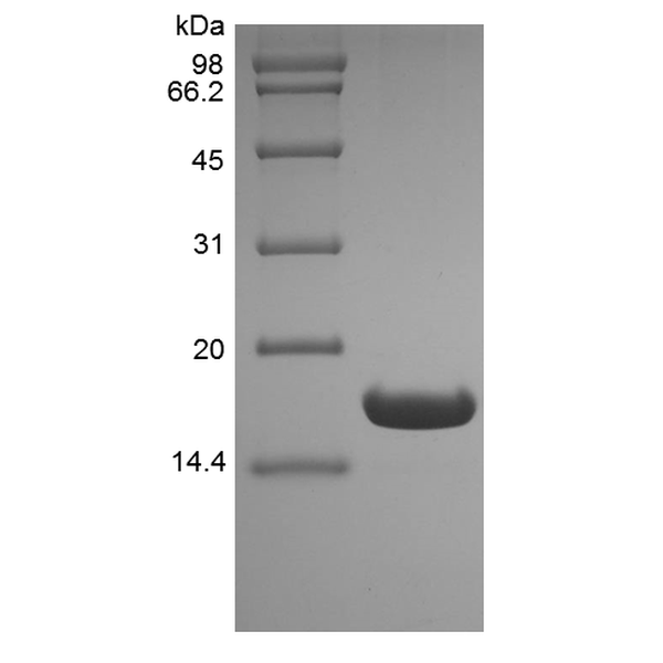 Recombinant Human UBE2B, His
