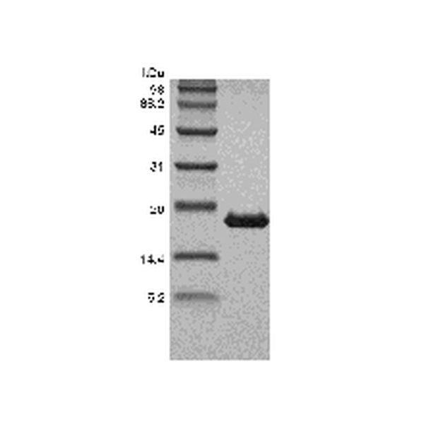 Recombinant Human Tumor Necrosis Factor-beta/TNFSF1