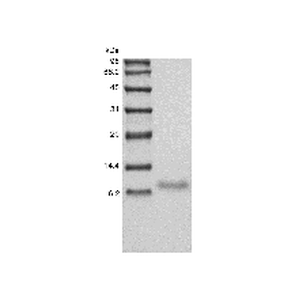 Recombinant Human TNF-related Weak Inducer of Apoptosis Receptor/TNFRSF12A
