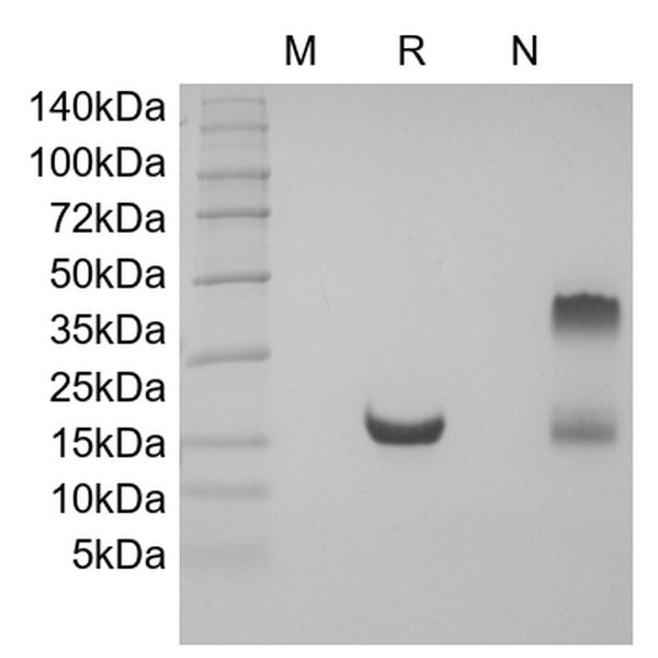 Recombinant Human soluble Tumor Necrosis Factor-Related Apoptosis-inducing Ligand Receptor-2/TNFRSF10B