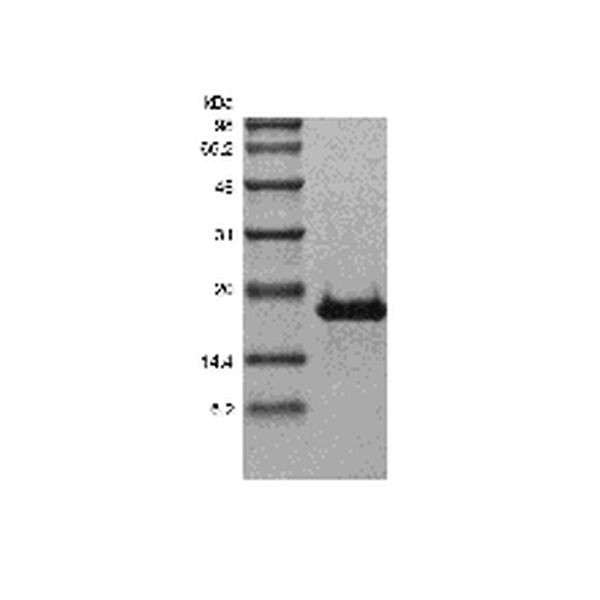 Recombinant Human Transmembrane Activator and CAML Interactor/TNFRSF13B