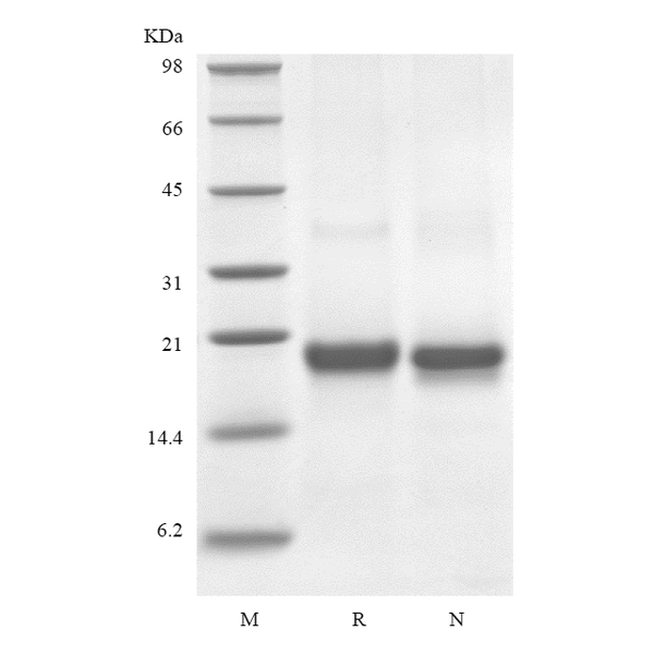 Recombinant Human soluble Fas Receptor/TNFRSF6