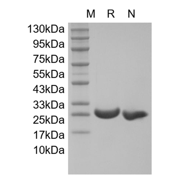 Recombinant Human soluble Receptor Activator of Nuclear Factor kappa-B Receptor/TNFRSF11A