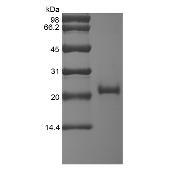 Recombinant Human soluble Tumor Necrosis Factor Receptor Type II/TNFRSF1B