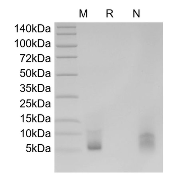 Recombinant Human Epiregulin