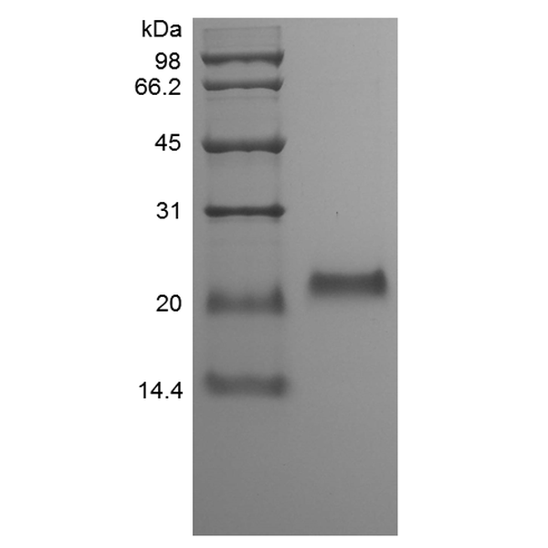 Recombinant Human Osteoprotegerin