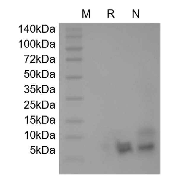 Recombinant Human Beta-defensin 5