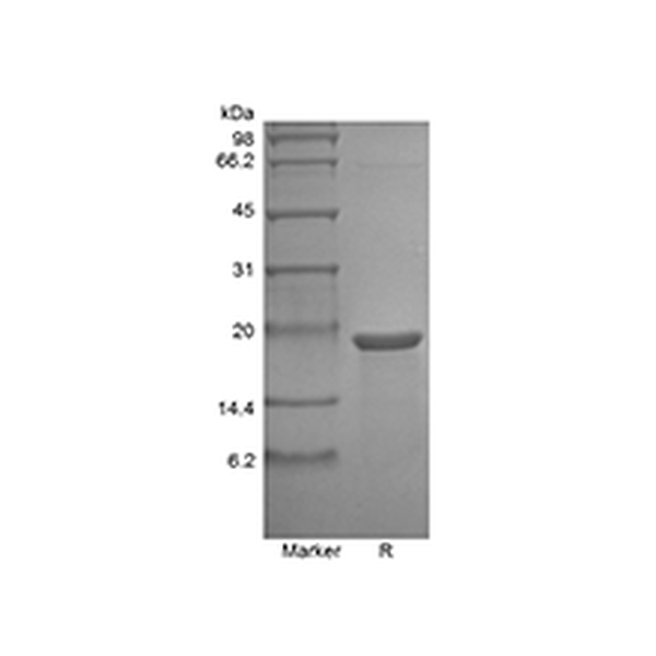 Recombinant Murine Mesencephalic Astrocyte-Derived Neurotrophic Factor