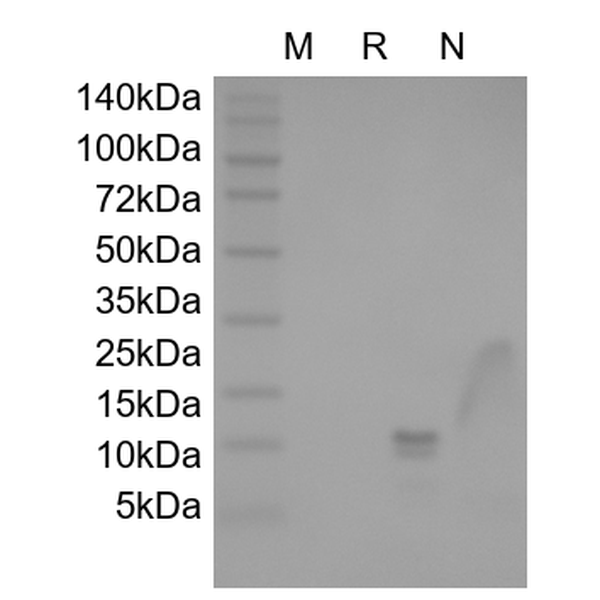 Recombinant Human Macrophage Inflammatory Protein-1 beta/CCL4