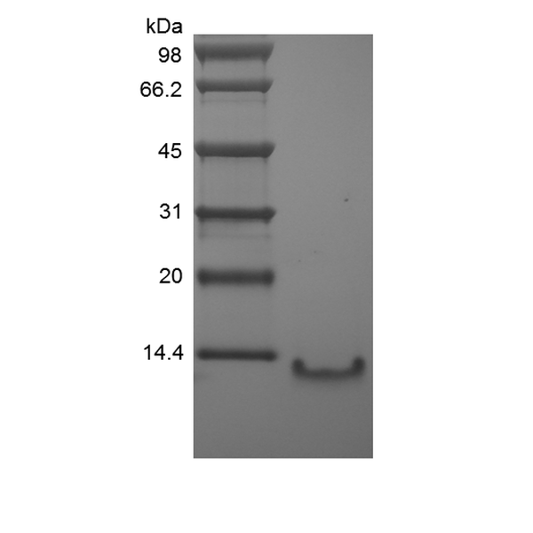 Recombinant Human Lymphocyte Activation Gene 1 Protein/CCL4L1