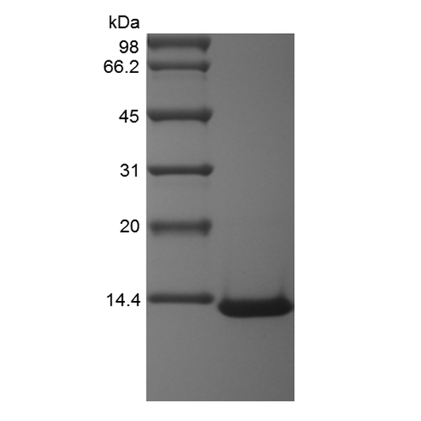 Recombinant Human Monocyte Chemotactic Protein-3/CCL7
