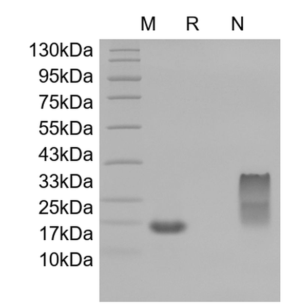 Recombinant Human Monocyte Chemotactic Protein-4/CCL13