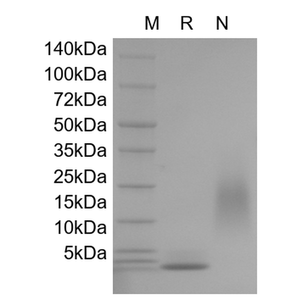Recombinant Human Hemofiltrate CC Chemokine-1/CCL14