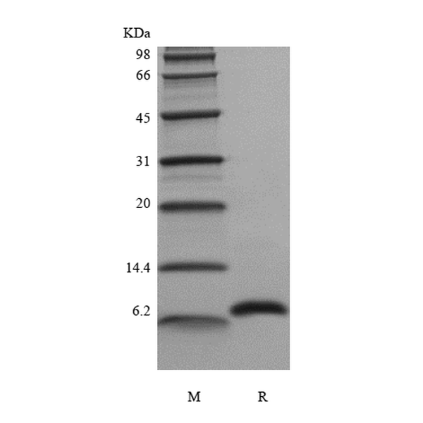 Recombinant Human Hemofiltrate CC Chemokine-1, 66a.a./CCL14