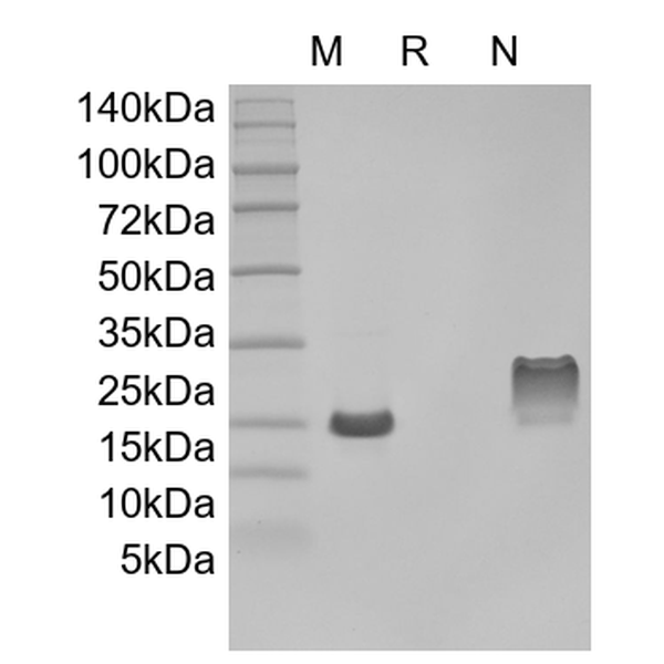 Recombinant Human Thymus Expressed Chemokine/CCL25