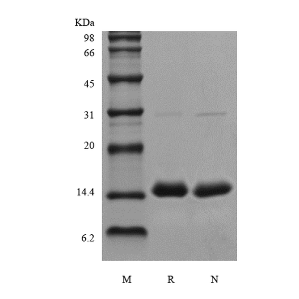Recombinant Human PCT/Procalcitonin