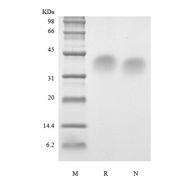 Recombinant Human Parathyroid Hormone 53-84