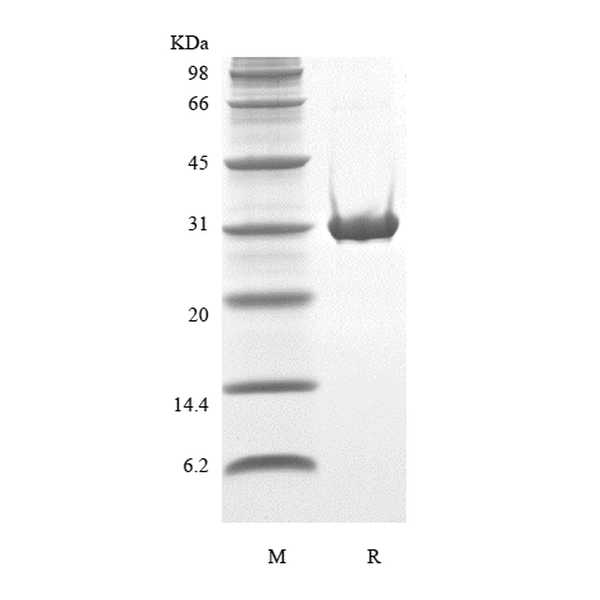 Recombinant Human TP53-induced Glycolysis and Apoptosis Regulator-TAT