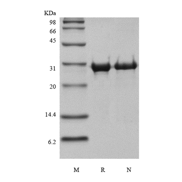 Recombinant Human Matrix metalloproteinase-14