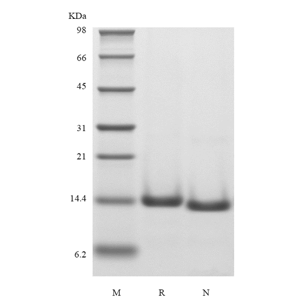Recombinant Human Cystatin-C