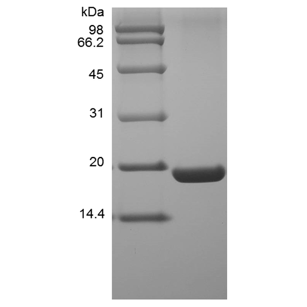 Recombinant Human UBE2I/UBC9 Protein, His