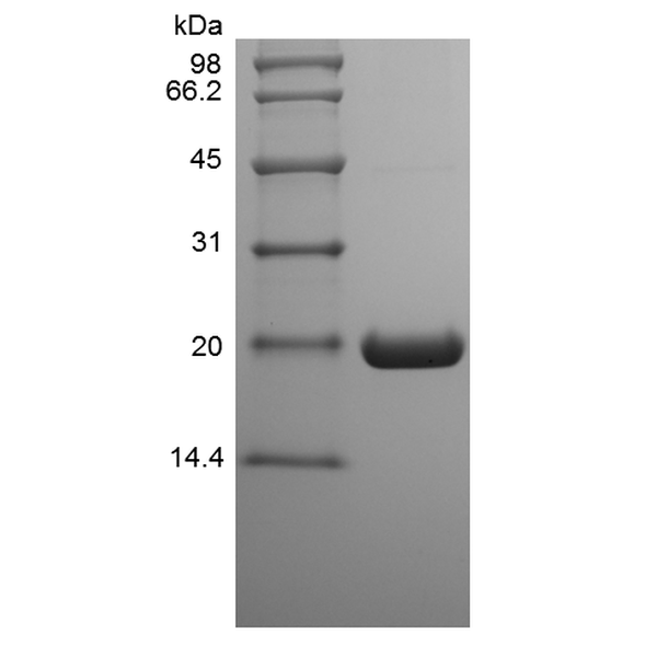Recombinant Human Ubiquitin-conjugating Enzyme E2 C, His