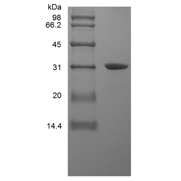 Recombinant Human High Mobility Group Box-1 Protein, His