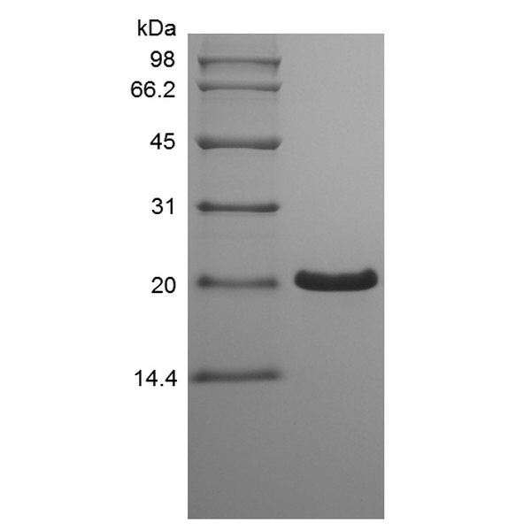 Recombinant Human Trefoil Factor 1