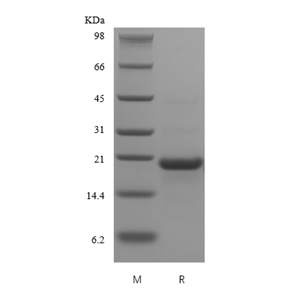 Recombinant Human soluble CD23