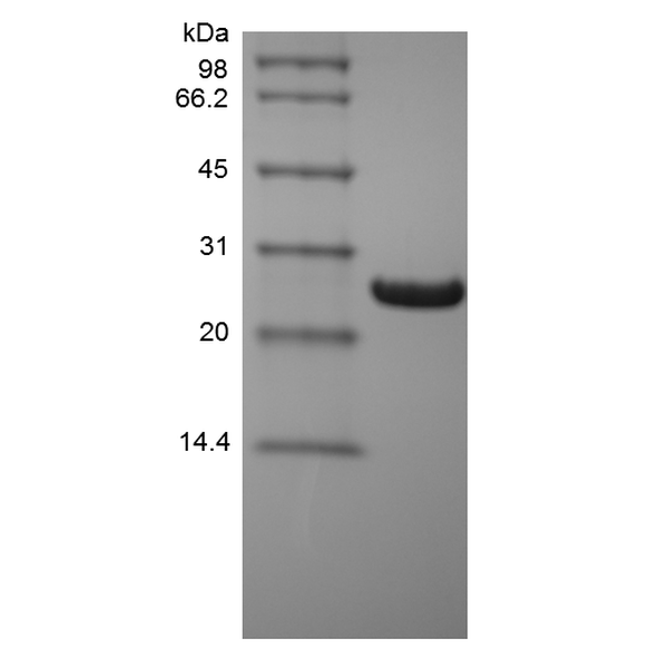 Recombinant Human B-cell Lymphoma-extra Large