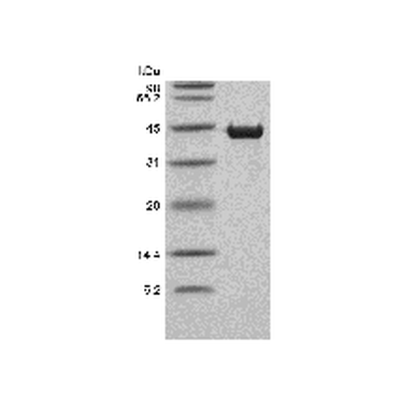 Recombinant Human Cardiac muscle troponin T